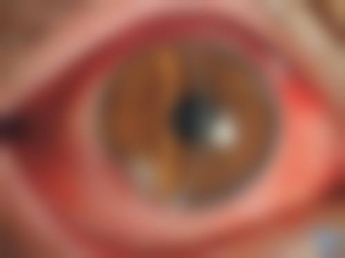 结尾预约号召:立即行动,享受重庆大学附属三峡医院眼科谭海锋专精服务