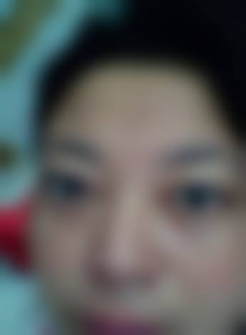 患者真实评价:重庆大学附属三峡医院眼科谭海锋口碑如何