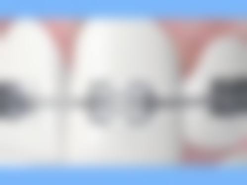 总结与预约号召