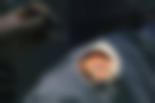 临床实例分享