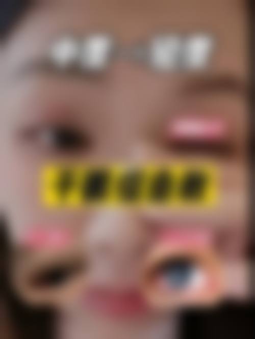 临床实例分享:真实患者的治疗反馈