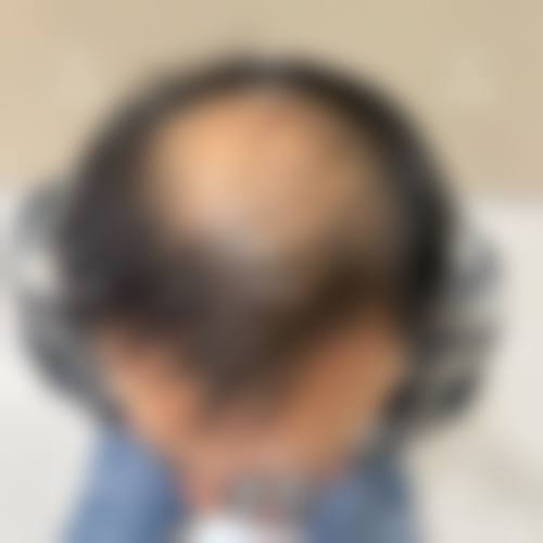 曾鸣等骨干医生领衔,烧伤整形与微创美容双优