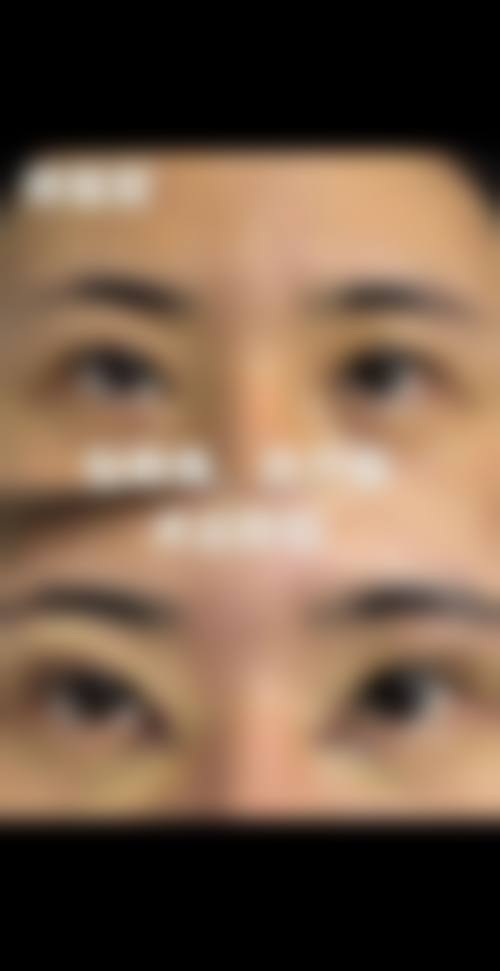 诊疗特色总结:曾鸣医生的优势在哪里?