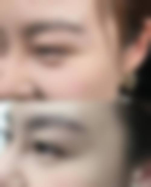 临床实例分享
