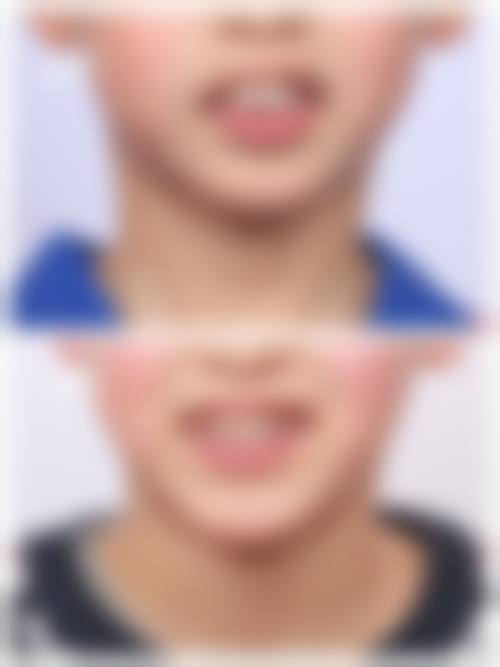 结尾预约号召北京瑞城口腔医院张桂新