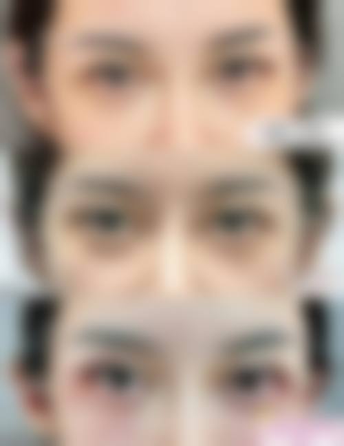 总结与预约指引:开启您的美丽蜕变之旅