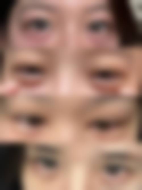 设备环境与安心保护:进口设备打造无菌手术室