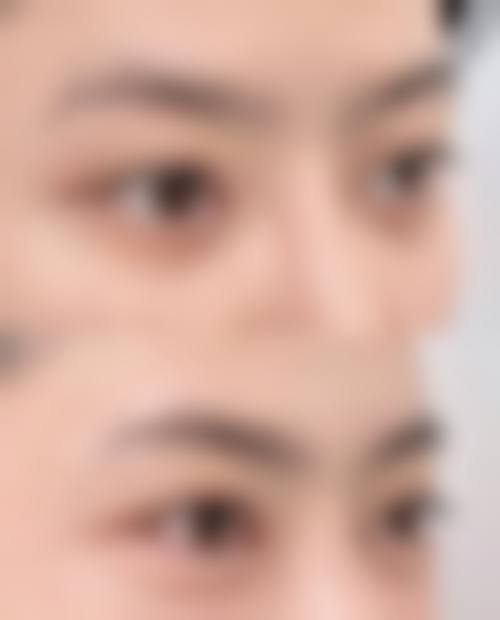 特色科室与技术优势:专注眼部与鼻部整形