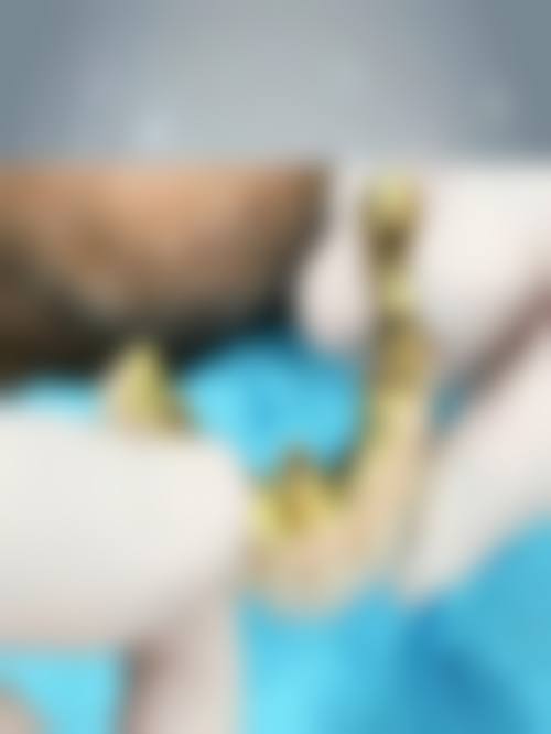 擅长项目详解:精细匹配各类口腔需求