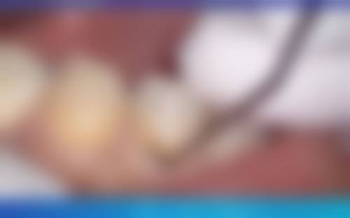 总结与预约指南：把握机会重拾自信笑容