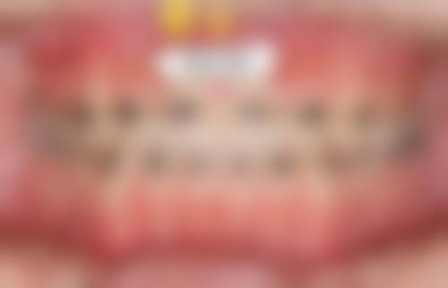 预约优惠活动:专属补贴助力轻松看牙