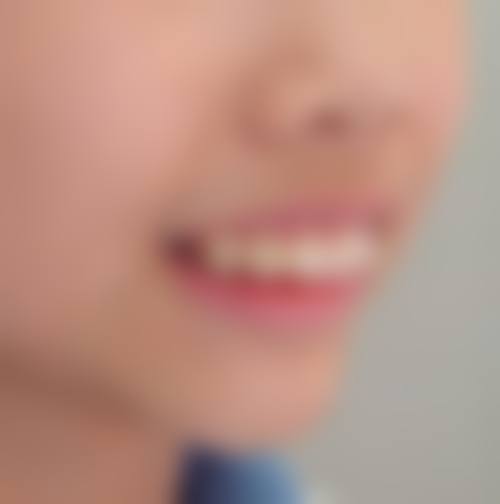 擅长项目详解