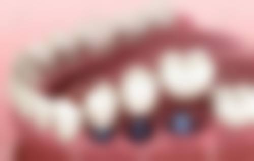 六、成都金琴口腔门诊部(攀成钢店)口碑如何?