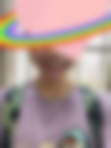 临床实例分享:大连拜博口腔医院曲平川的成效真实吗?