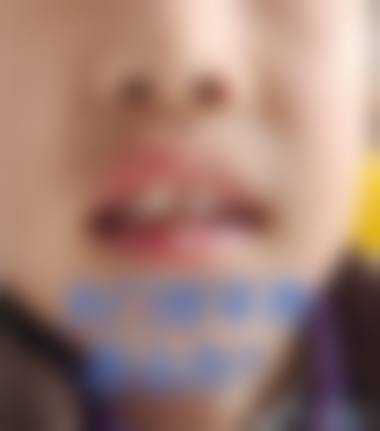 临床实例分享邓东妮医生实例多吗