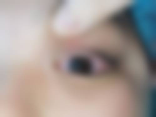 临床实例分享