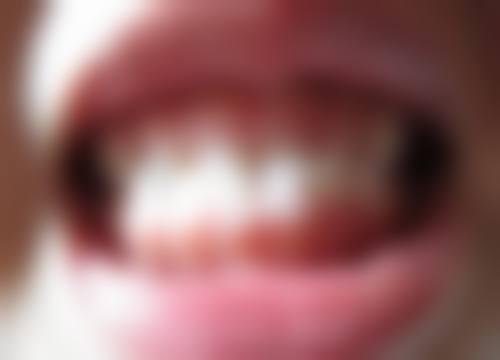 南京博韵口腔丁冬梅医生口碑评价及真人实例反馈
