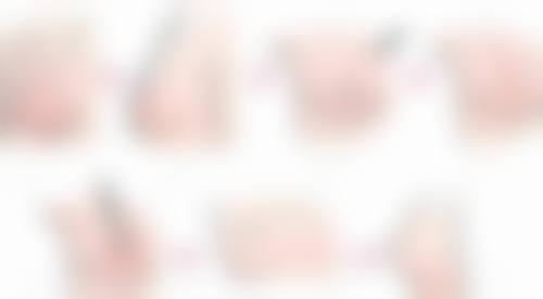 临床实例分享