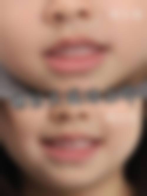 八、西安爱笑口腔诊所怎么预约?