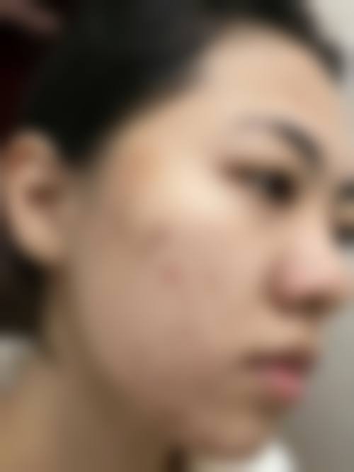 患者真实评价