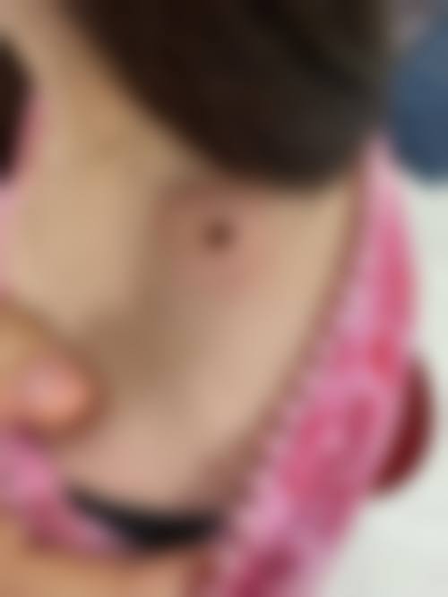临床实例分享