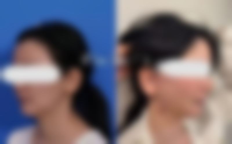 医生资质介绍:韩国YNT整形外科医院李秉烈的具有影响力背景