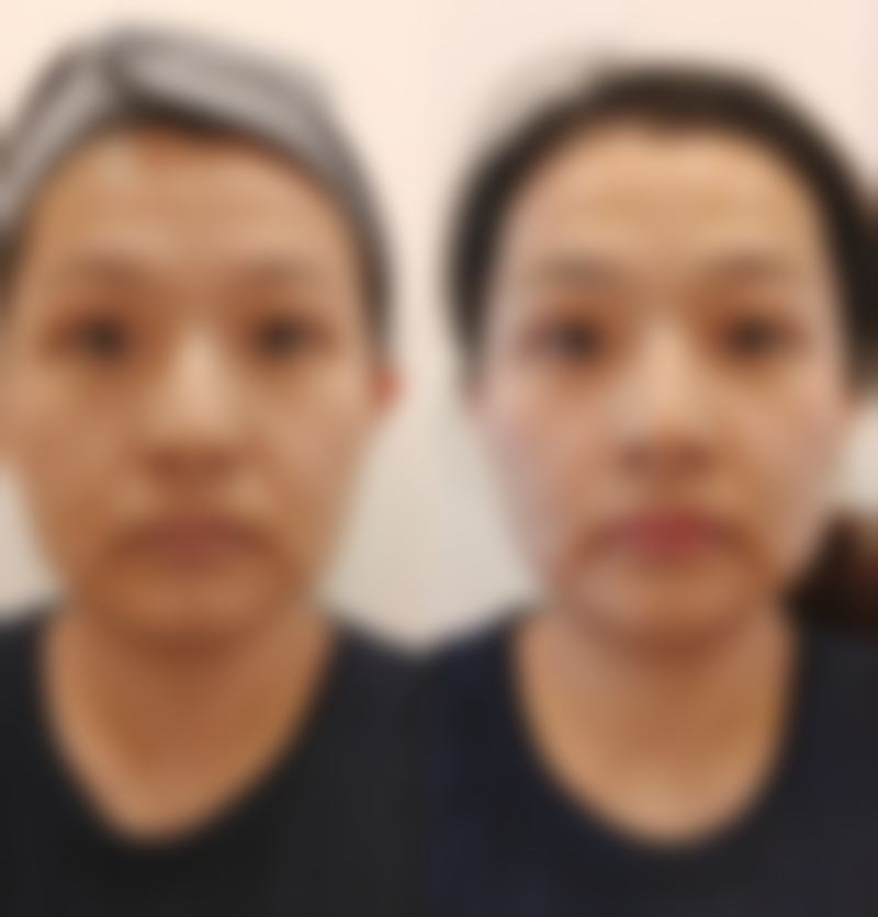 擅长项目详解:尹炯老医生核心技术