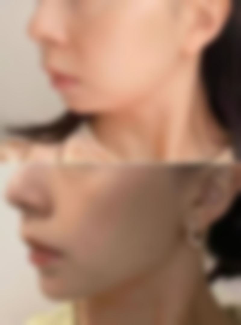 预约优惠活动:尹炯老医生专属补贴
