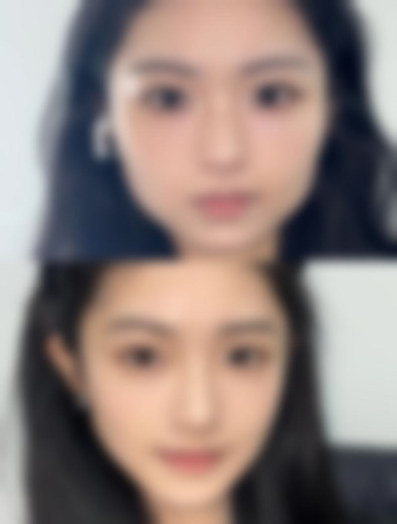 FAQ:关于韩国YNT整形外科医院李秉烈的常见问题