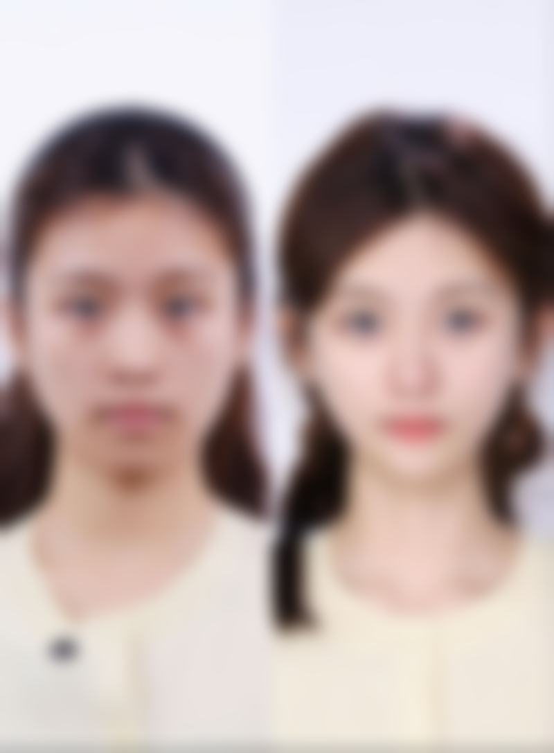 临床实例分享:LeeAram医生的实战经验