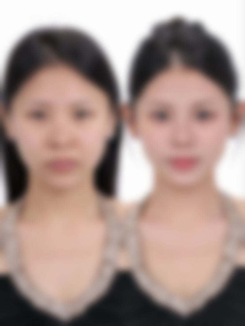 预约优惠活动:LeeAram医生的专属补贴