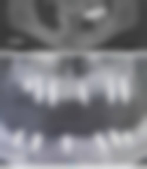 预约优惠活动