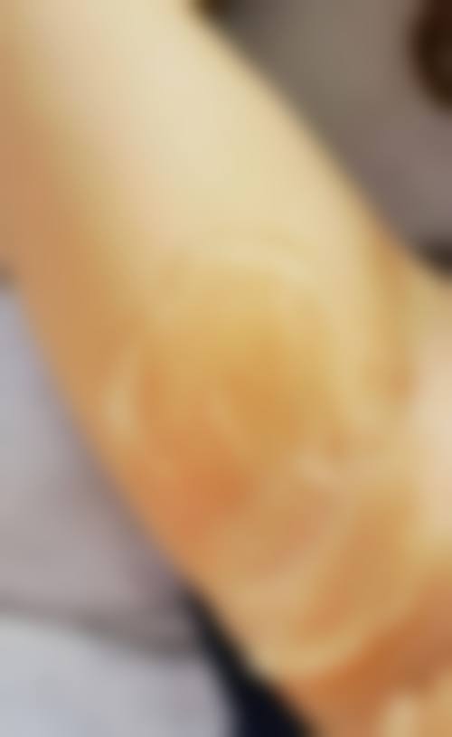 患者真实评价:口碑积累源于专精