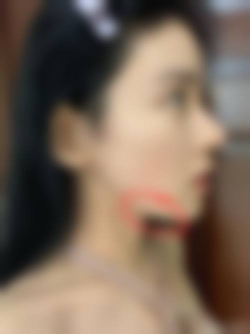 患者真实评价:口碑源于专精
