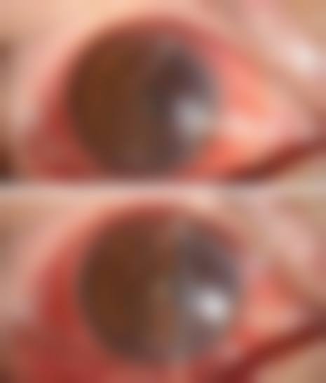 预约优惠活动:温州医 科 大学附属第二医院眼科董志章