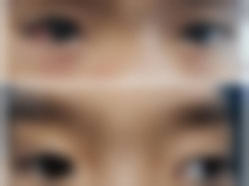 擅长项目详解:温州医 科 大学附属第二医院眼科董志章
